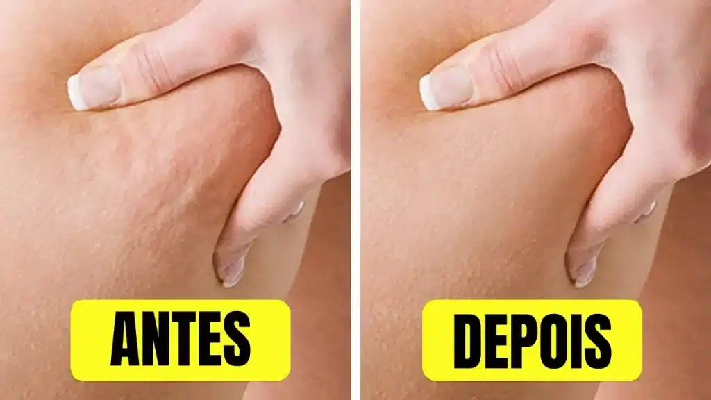 الأطعمة التي تساعد على تقليل سيلوليت الأفخاذ