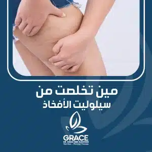 مين تخلصت من سيلوليت الأفخاذ