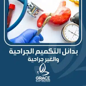 بدائل التكميم الجراحية والغير جراحية
