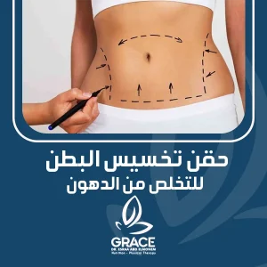 حقن تخسيس البطن للتخلص من الدهون