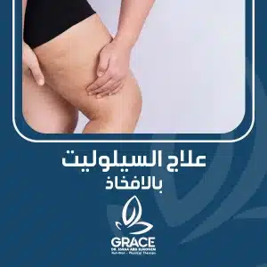 علاج السيلوليت بالافخاذ
