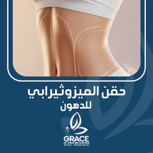 حقن الميزوثيرابي للدهون
