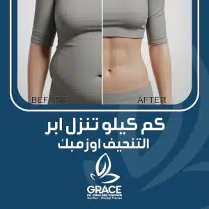 كم كيلو تنزل ابر التنحيف اوزمبك